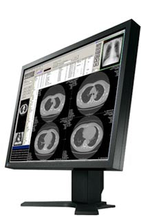 Medical Monitors